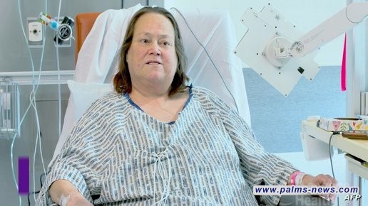 "ليزا" تفارق الحياة بعد زراعة كلية خنزير